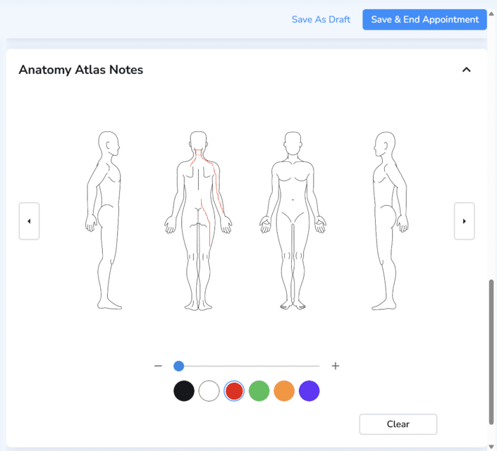 Draw on anatomical diagrams